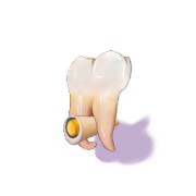 口腔解剖生理学（利用填空的方式背论述题）卡包封面
